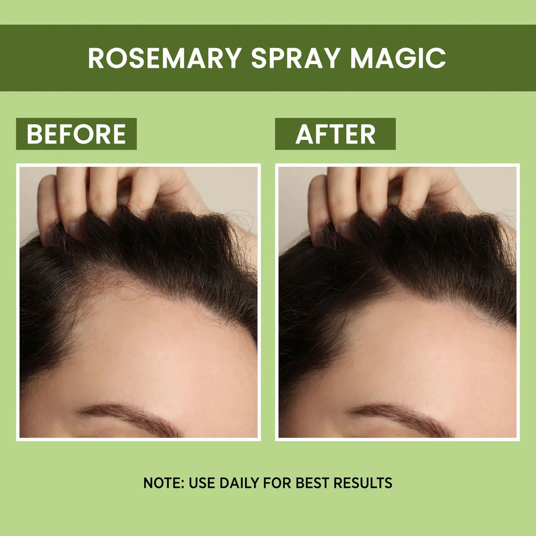 Rosemary Water, Hair Spray For Regrowth (Pack of 2 Bottle & 1 Sprayer)